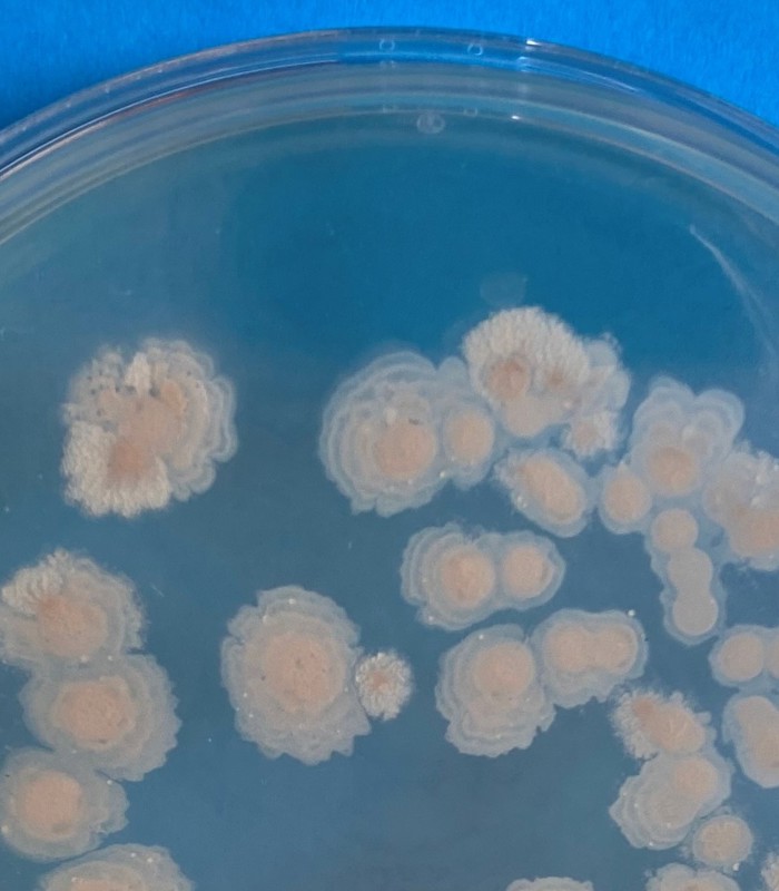Microbial contaminants